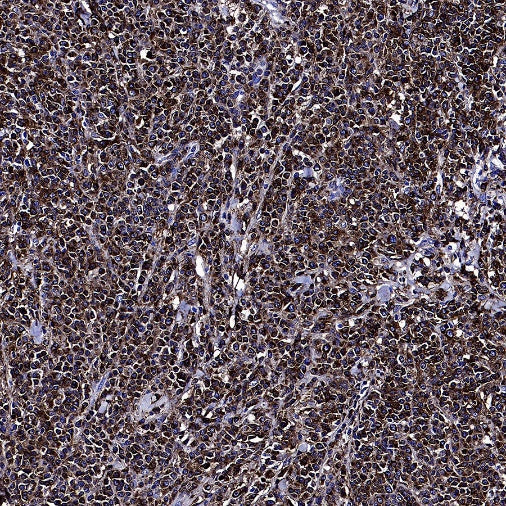 CD74 Recombinant Rabbit mAb (S-4524-58)