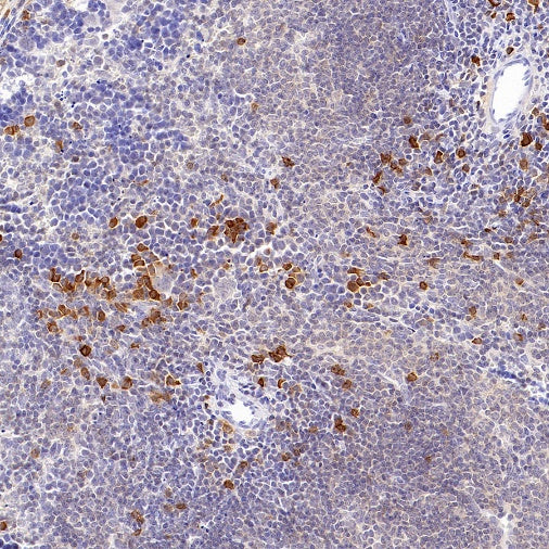 CD25/IL-2Rα Recombinant Rabbit mAb (SDT-2234-65)