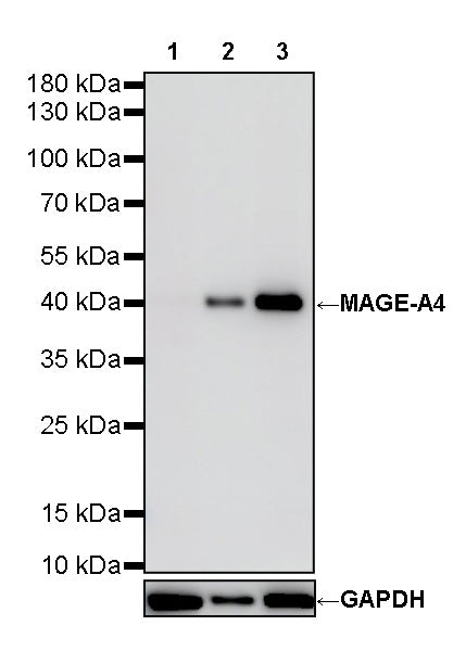 MAGE-A4 Recombinant Rabbit mAb (S-3868-66)