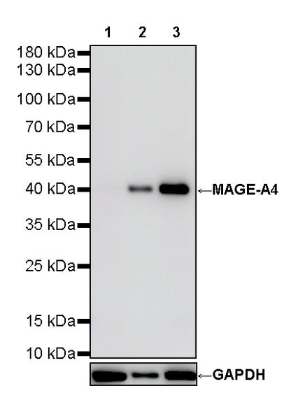 MAGE-A4 Recombinant Rabbit mAb (S-3868-66)