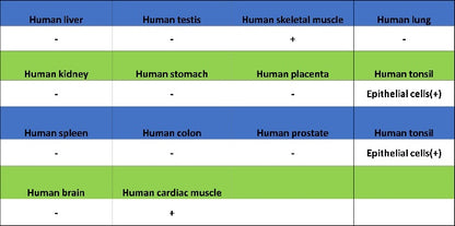 PDX1 Rabbit Polyclonal Antibody