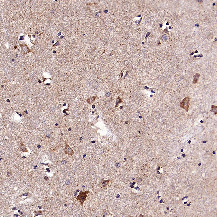KCNMA1 Recombinant Rabbit mAb (S-2926-33)