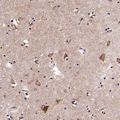 KCNMA1 Recombinant Rabbit mAb (S-2926-33)