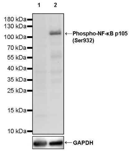 Phospho-NF-κB p105 (Ser932) Recombinant Rabbit mAb (S-1146-117)