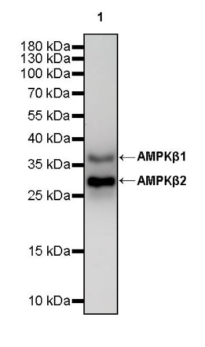 AMPKβ1/2 Recombinant Rabbit mAb (S-2728-26)