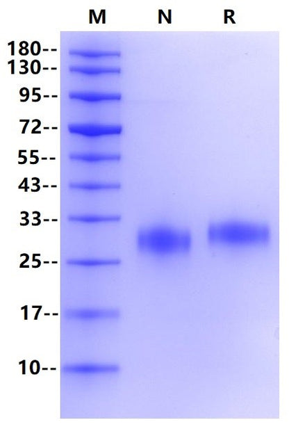 Fc γ RIIB/CD32b His Tag Protein, Human
