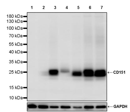 CD151 Recombinant Rabbit mAb (S-3235-104)