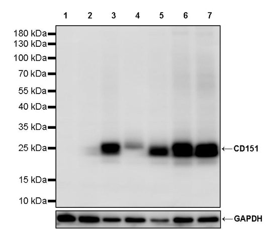 CD151 Recombinant Rabbit mAb (S-3235-104)