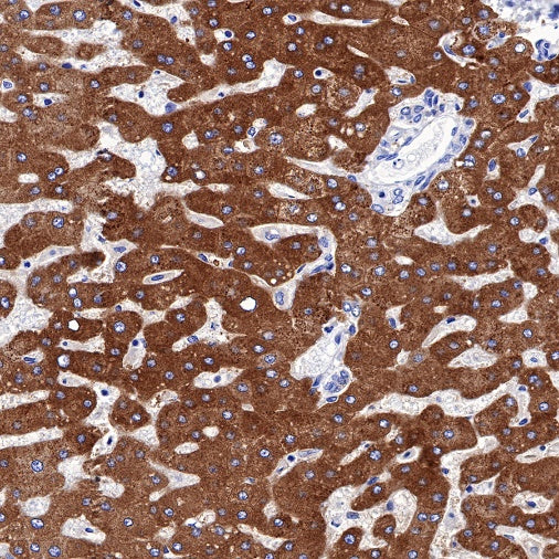 CPS1 Recombinant Rabbit mAb (S-674-9)
