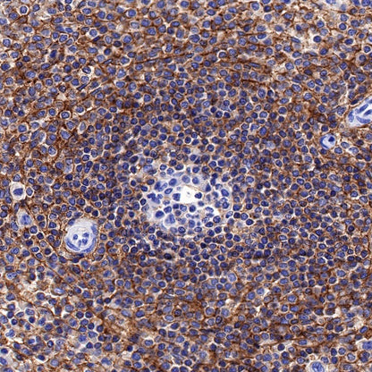 CD44 Recombinant Rabbit mAb (S-944-25)