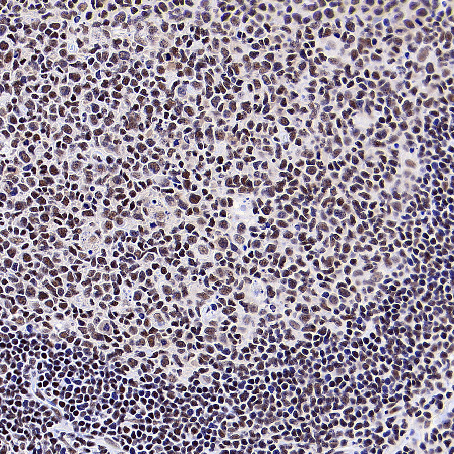 YY1 Recombinant Rabbit mAb (S-3652-44)