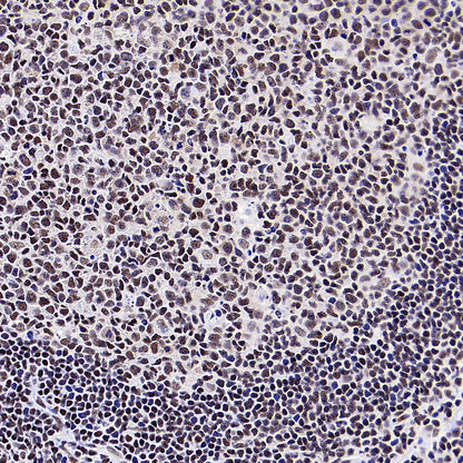 YY1 Recombinant Rabbit mAb (S-3652-44)
