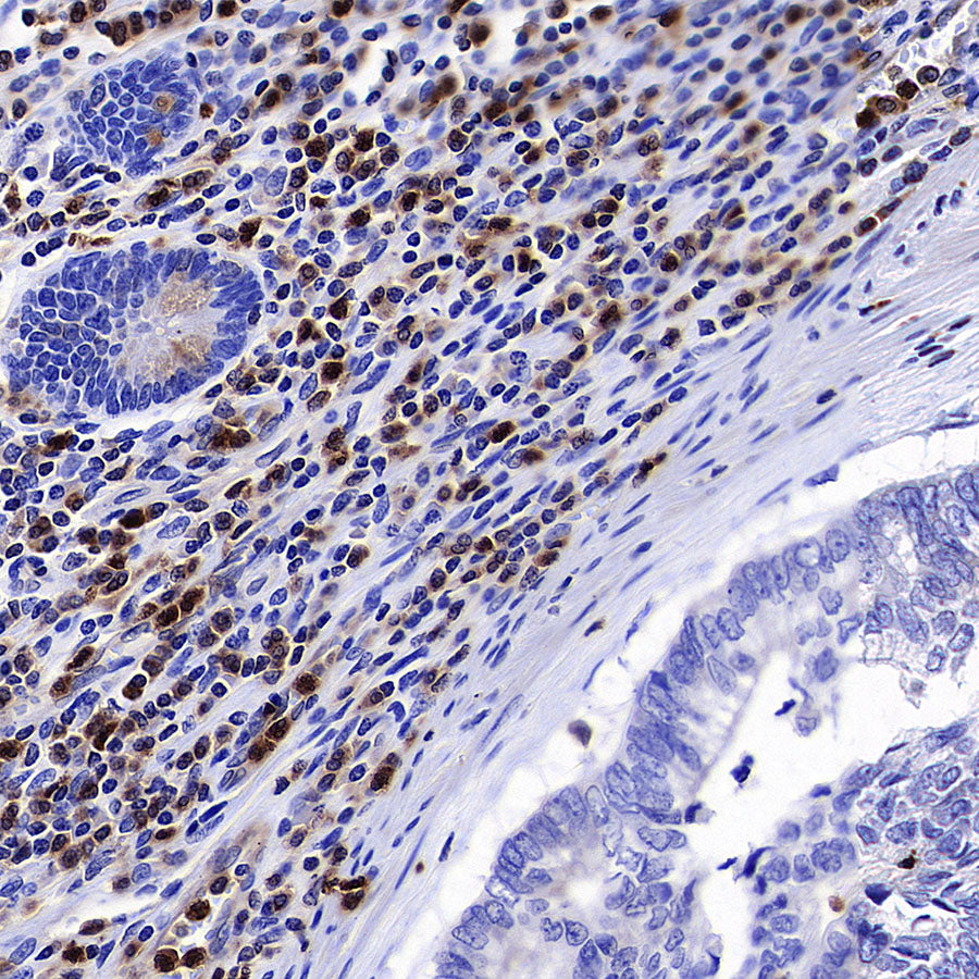 RAB27A Mouse mAb (S-M0050)