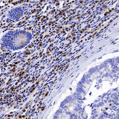 RAB27A Mouse mAb (S-M0050)