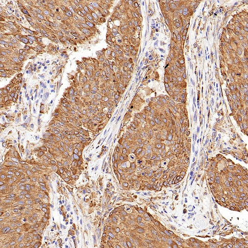 P4HB Recombinant Rabbit mAb (S-1524-120)