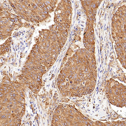P4HB Recombinant Rabbit mAb (S-1524-120)