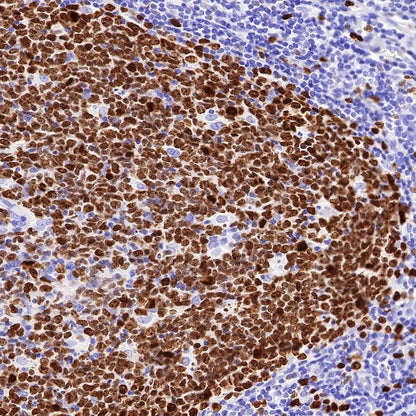 S-RMab® Ki67 Recombinant Rabbit mAb (SDT-10002)
