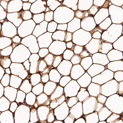 ATGL Recombinant Rabbit mAb (S-5284)