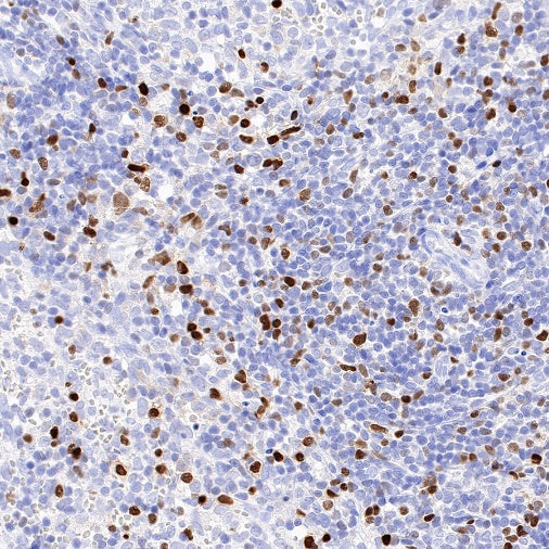 T-bet/TBX21 Recombinant Rabbit mAb (S-583-54)