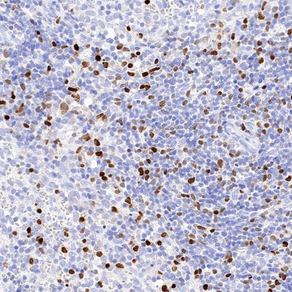 T-bet/TBX21 Recombinant Rabbit mAb (S-583-54)
