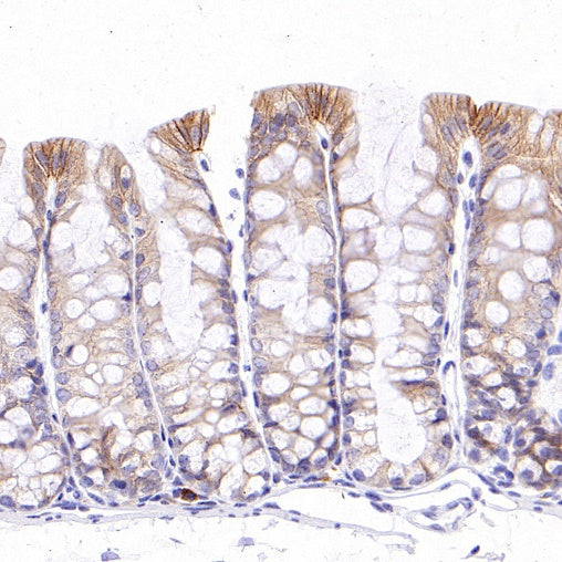 ErbB3 Recombinant Rabbit mAb (SDT-991-14)