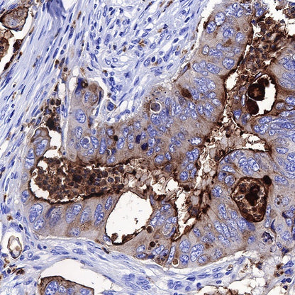 CD66a/CEACAM1 Recombinant Rabbit mAb (S-678-53)