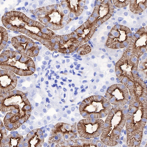 Aquaporin 1/AQP1 Recombinant Rabbit mAb (S-794-79)