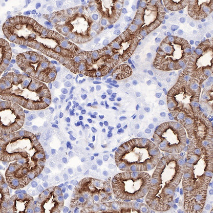 Aquaporin 1/AQP1 Recombinant Rabbit mAb (S-794-79)