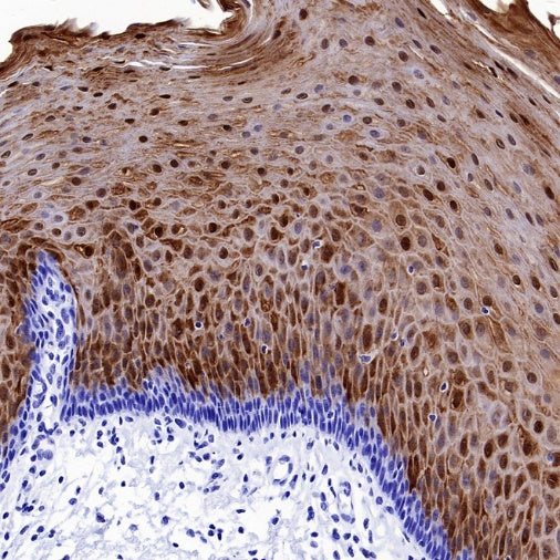 SERPINB3 Recombinant Rabbit mAb (S-4587)