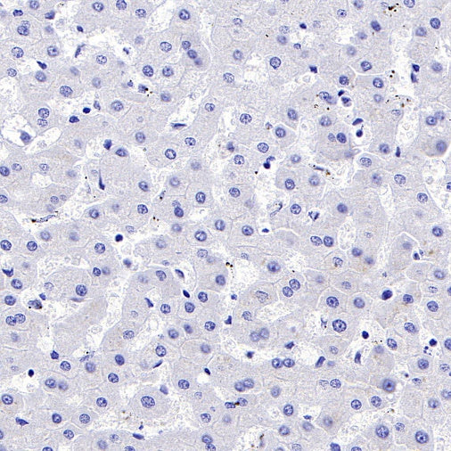 GLUT4 Recombinant Rabbit mAb (S-584-50)