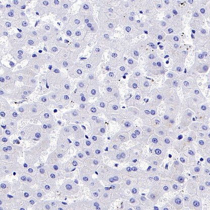 GLUT4 Recombinant Rabbit mAb (S-584-50)