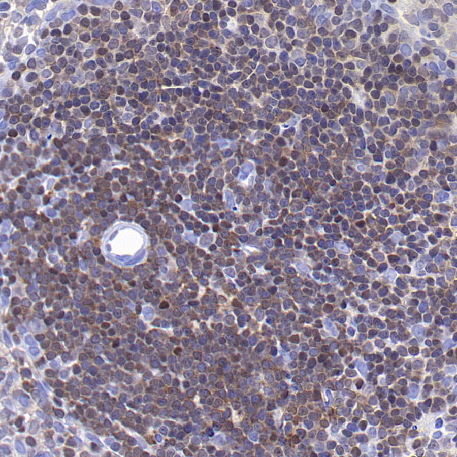 FoxO1 Recombinant Rabbit mAb (S-5118)