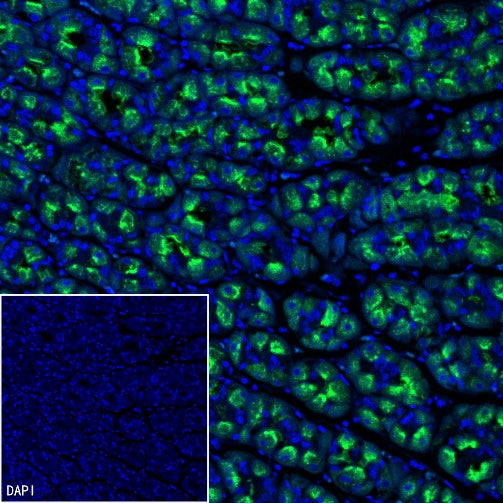 ATP4B Recombinant Rabbit mAb (SDT-2445-64)