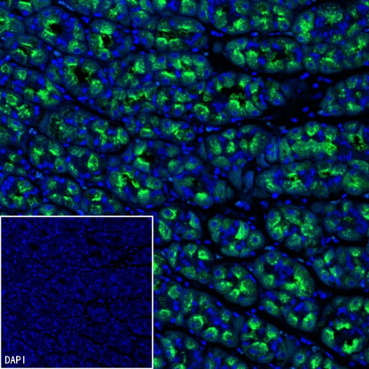 ATP4B Recombinant Rabbit mAb (SDT-2445-64)