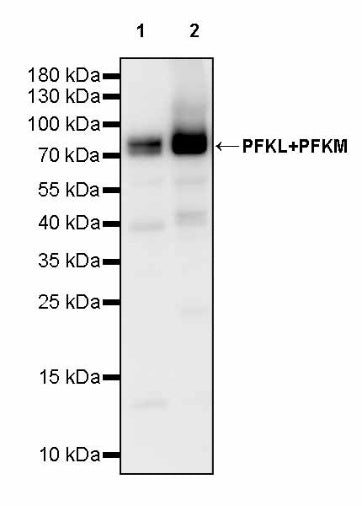 PFKL+PFKM Recombinant Rabbit mAb (S-1302-31)