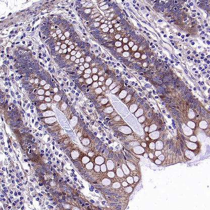 KLHL21 Recombinant Rabbit mAb (S-3460-252)