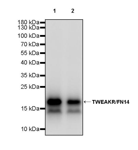 TWEAKR/FN14 Recombinant Rabbit mAb (S-913-1)