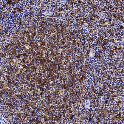 HLA-DRA Rabbit Polyclonal Antibody