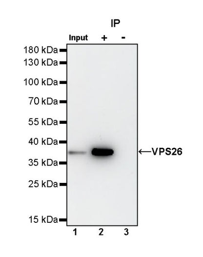 VPS26 Rabbit Polyclonal Antibody