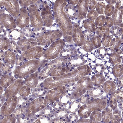 Bax Recombinant Rabbit mAb (S-2603-124)