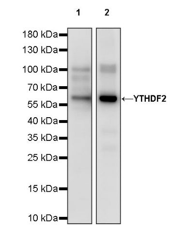 YTHDF2 Recombinant Rabbit mAb (S-1569-42)
