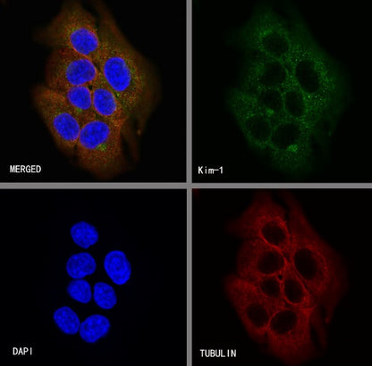KIM-1 Recombinant Rabbit mAb (S-932-2)