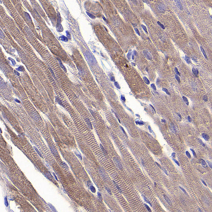 CHCHD2 Recombinant Rabbit mAb (S-4107-30)