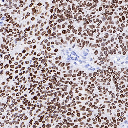 HMGA1 Recombinant Rabbit mAb (S-R332)