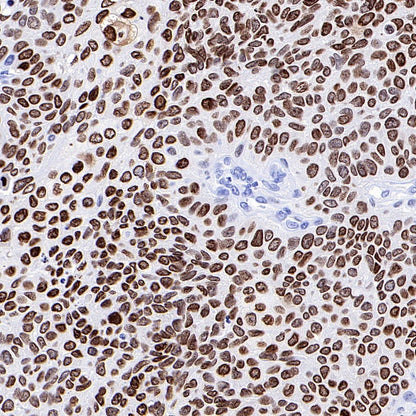 HMGA1 Recombinant Rabbit mAb (S-R332)