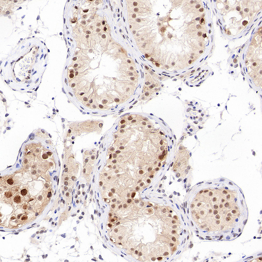 Phospho-Cdc25A (Ser124) Recombinant Rabbit mAb (S-5057-5)