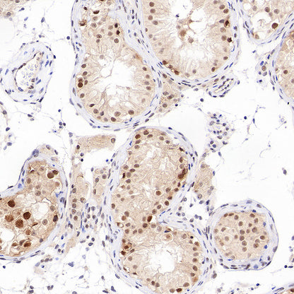 Phospho-Cdc25A (Ser124) Recombinant Rabbit mAb (S-5057-5)