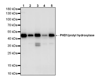 PHD1/prolyl hydroxylase Recombinant Rabbit mAb (S-5060-43)