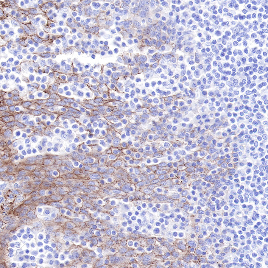 CD9 Recombinant Rabbit mAb,PBS Only (SDT-143-53)