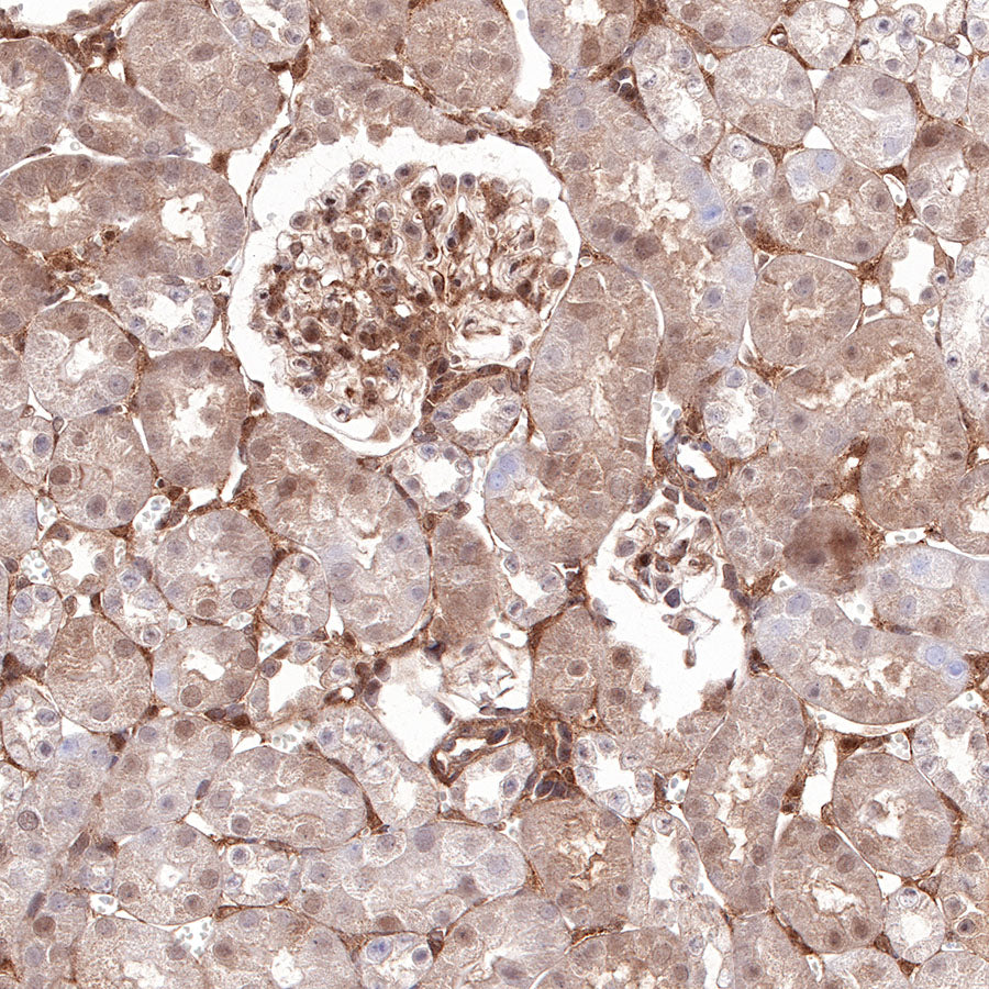 S-RMab® Stat6 Recombinant Rabbit mAb (SDT-337-32)
